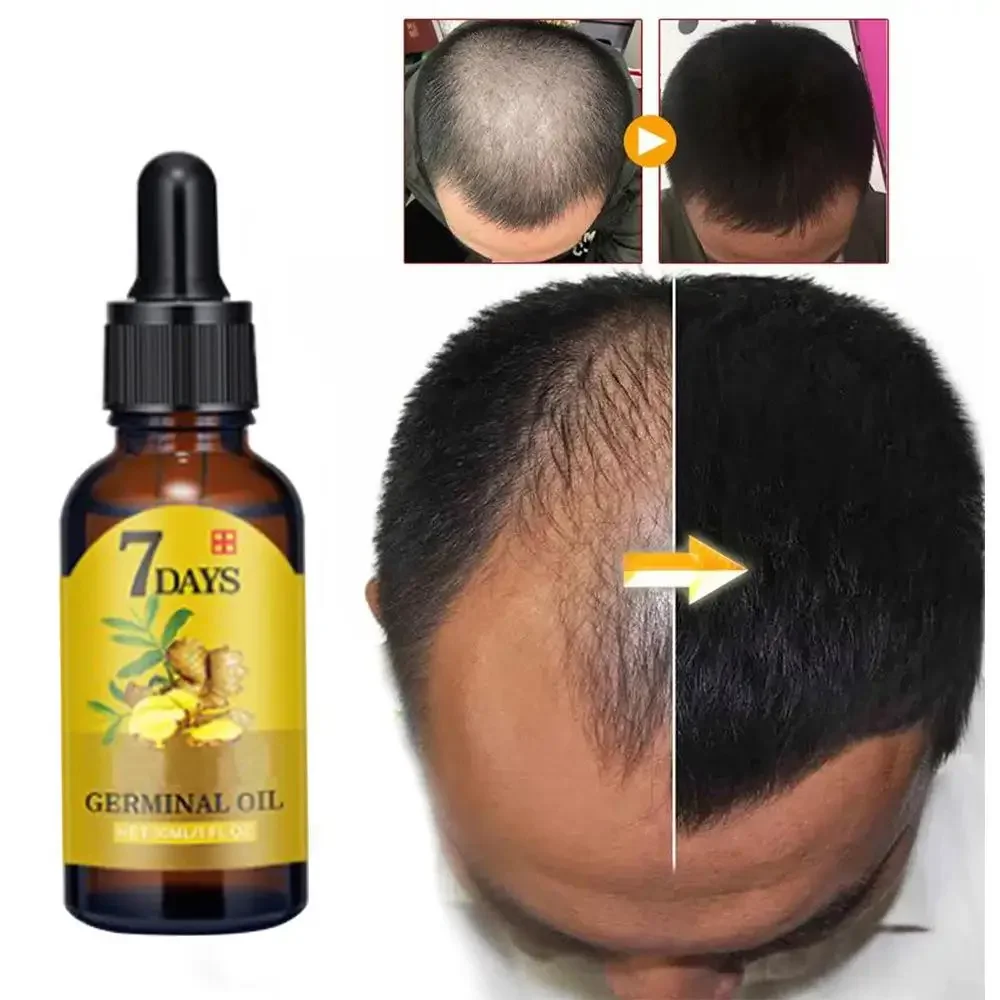 Hair Care Essential Oil Atomizing - Minyak esensial penumbuh rambut, minyak jahe