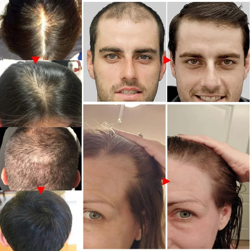Minyak esensial penumbuh rambu - Hair Care Essential Oil Atomizing ulasan dan harga