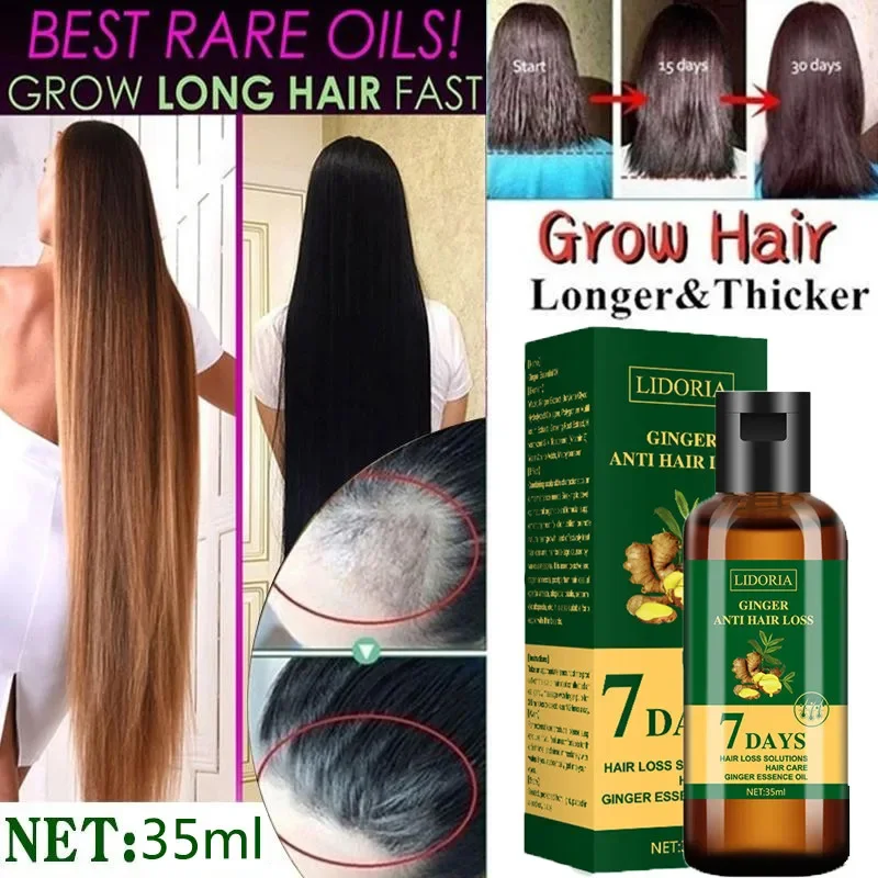 Minyak esensial penumbuh rambu - Hair Care Essential Oil Atomizing ulasan dan harga