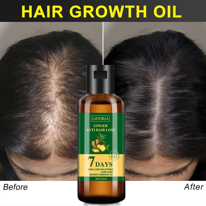 Minyak esensial penumbuh rambu - Hair Care Essential Oil Atomizing ulasan dan harga