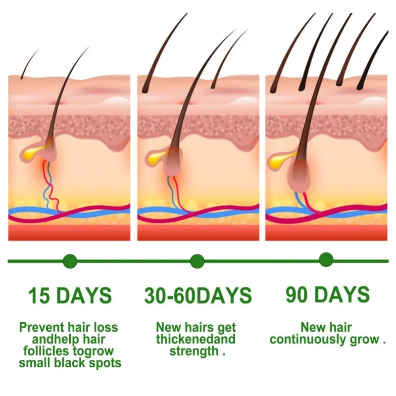 Serum Penumbuh Rambut Set Pera - Hair Care Essential Oil Atomizing ulasan dan harga