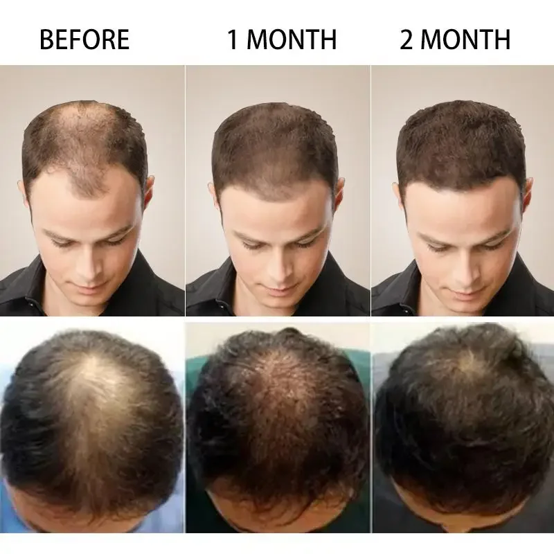 Minyak esensial penumbuh rambu - Hair Care Essential Oil Atomizing ulasan dan harga